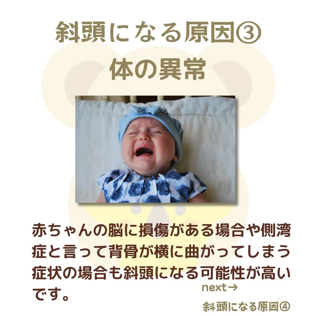 赤ちゃんの頭の形の悩みの中でも多いのが斜頭