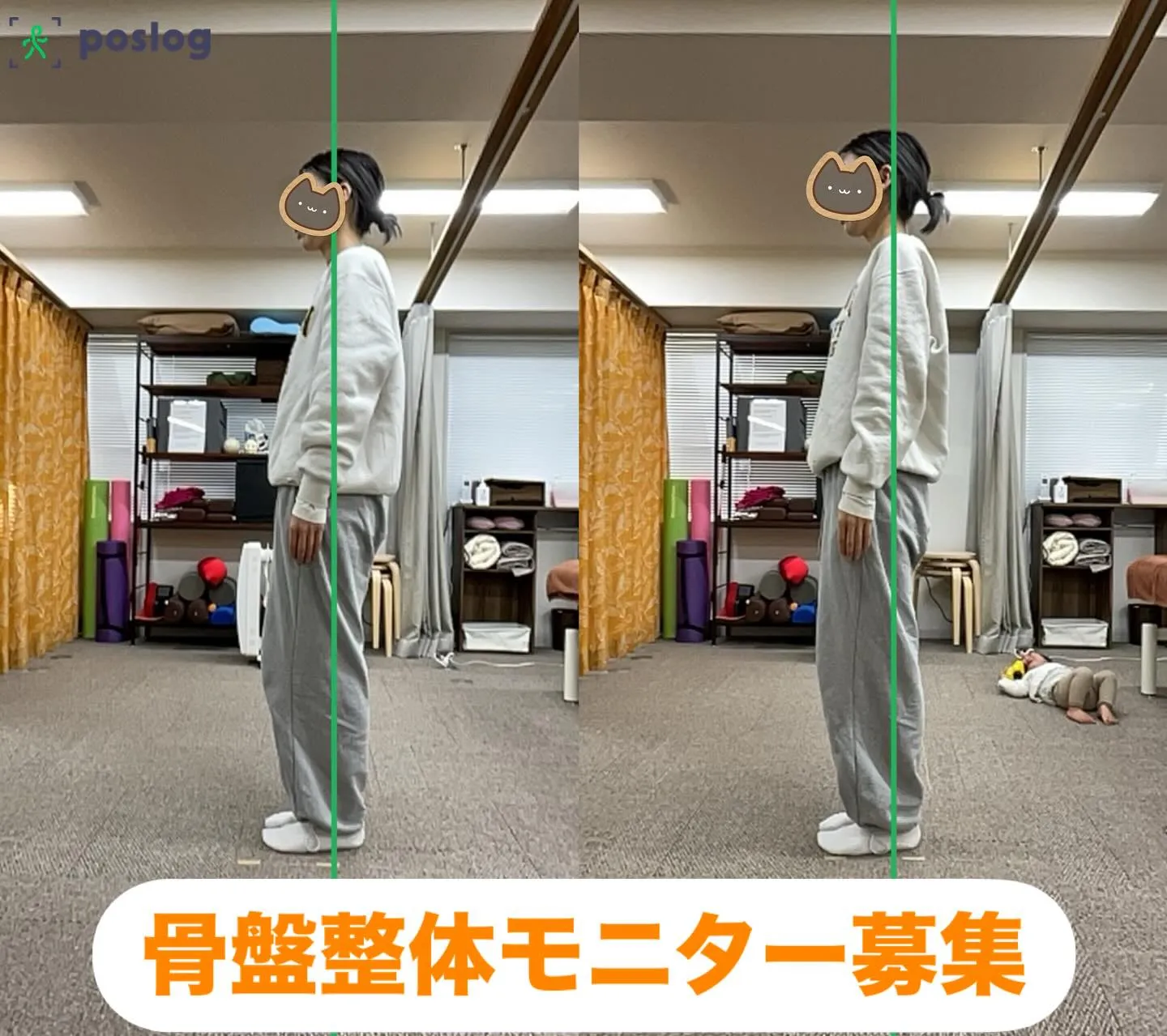 骨盤整体モニター募集します